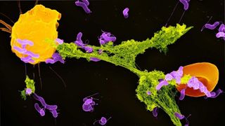 a microscopic image depicts a neutrophil casting a net to catch bacteria
