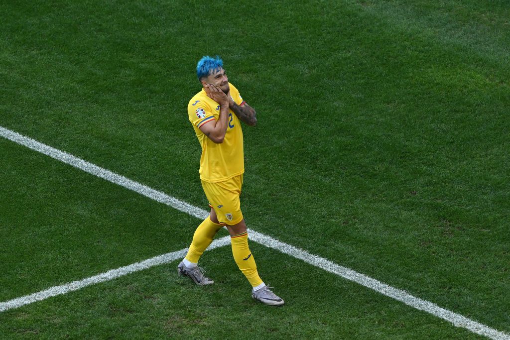 Romania player with blue hair