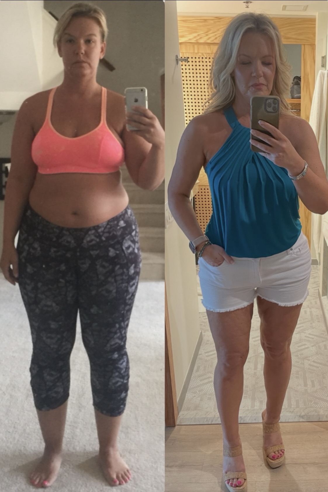 a before and after image of a white woman with blonde hair pre- and post-liposuction