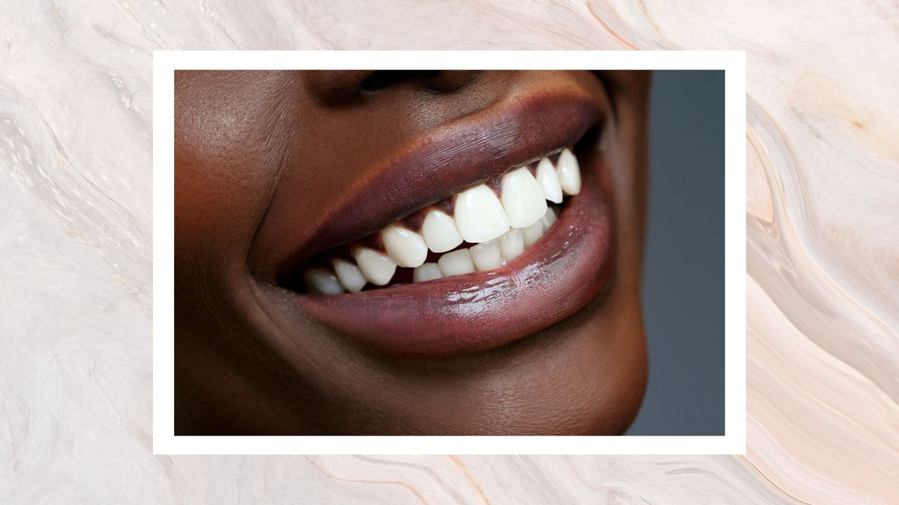 A woman&#039;s mouth shown smiling with perfectly white teeth on a grey backdrop and watercolour border