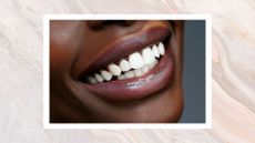 A woman's mouth shown smiling with perfectly white teeth on a grey backdrop and watercolour border