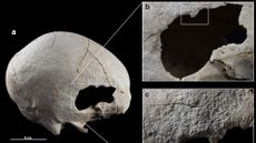 A skull with a hole in it (at right) and magnified images of the hole and scrape marks (at left)