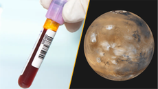 Split image of a blood test and the planet Mars. 