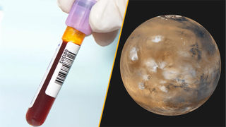 Split image of a blood test and the planet Mars.