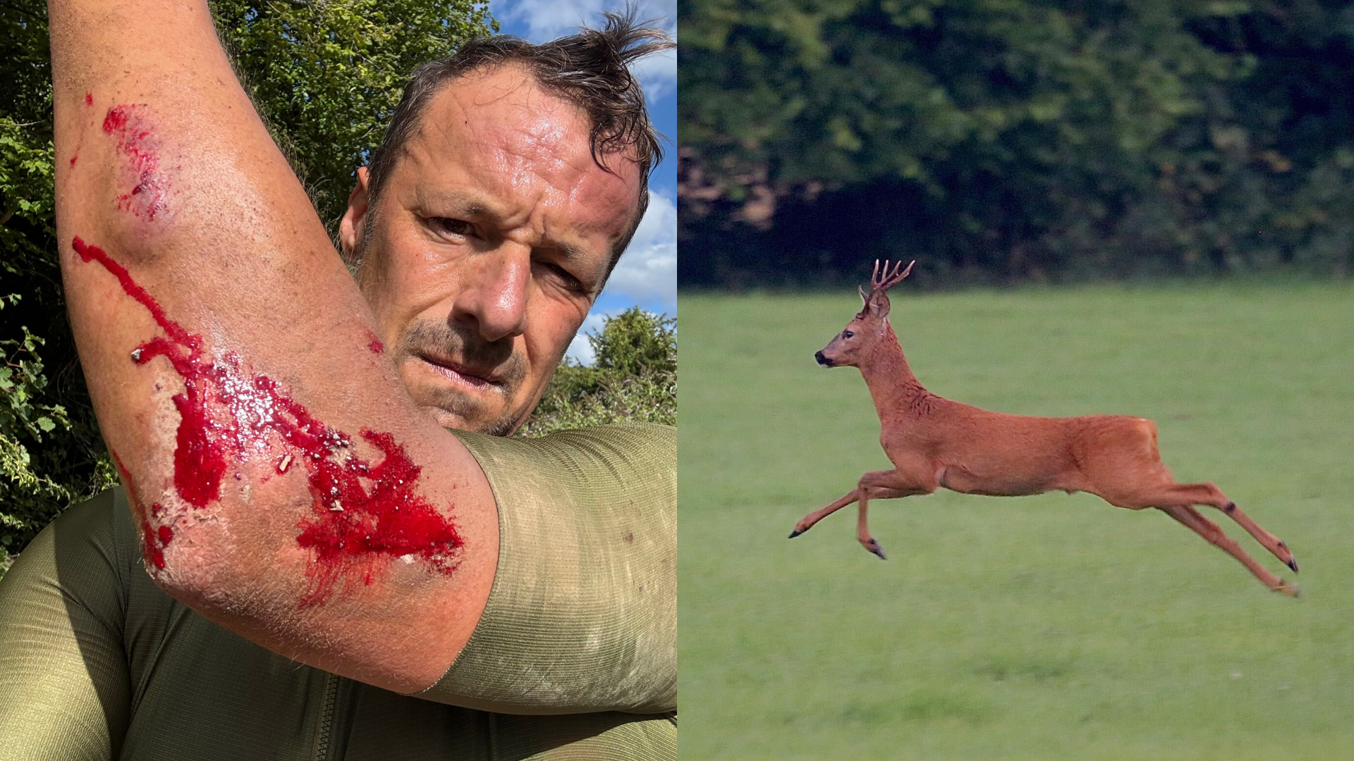 Steve's injuries (left) and his image of a deer