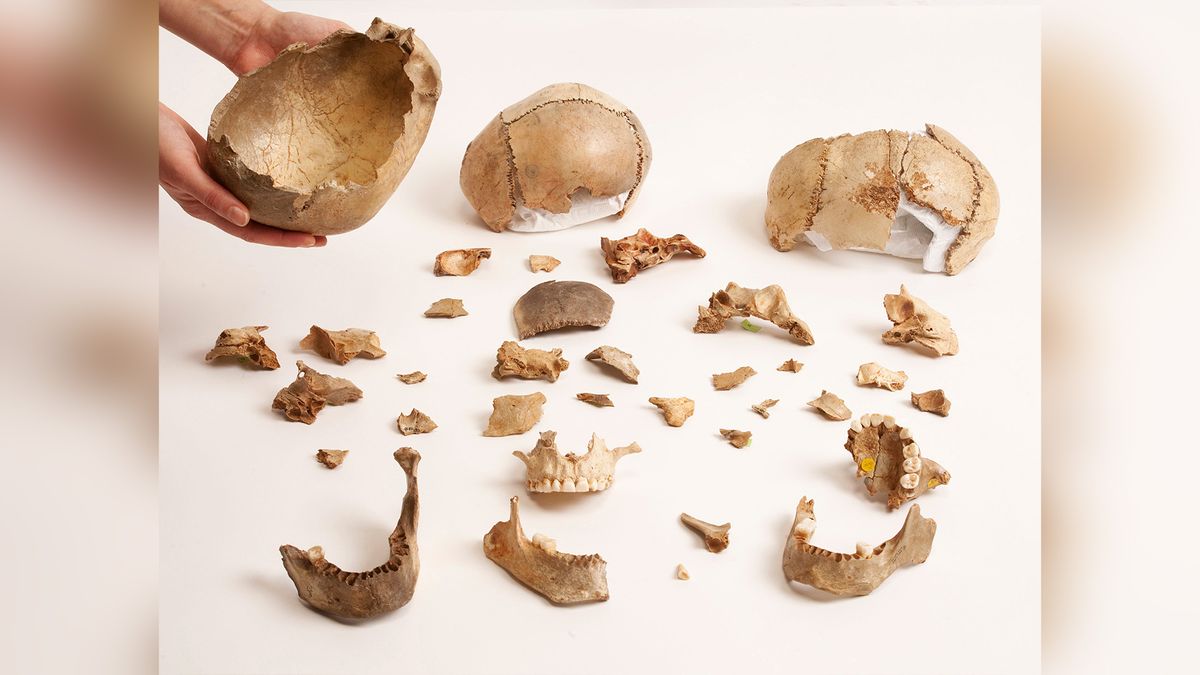 Human remains of mostly skull and jaw bone fragments are arranged as specimen samples on a white backdrop. 