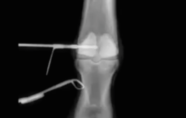 Xray.png
