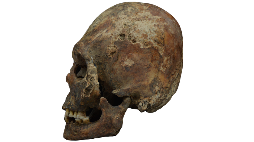 Side view of the left side of a human skull that has been artificially shaped, against a white background