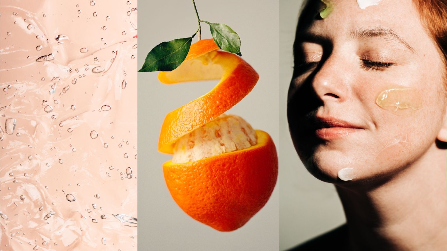 Does Vitamin C Help Acne-Prone Skin? Dermatologists Explain