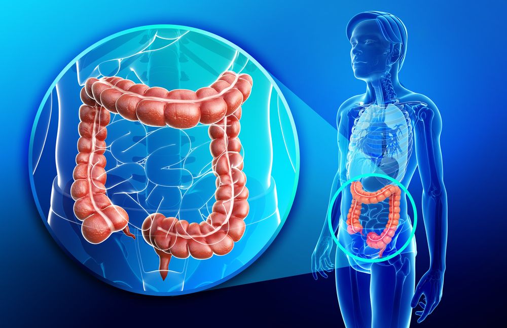 Crohn's disease: Symptoms, diagnosis & treatment