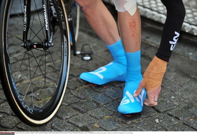 Chris Froome's wrist at the startline