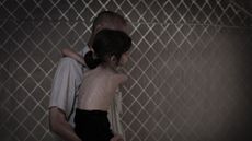 Palestinian girl faces starvation in Gaza Strip