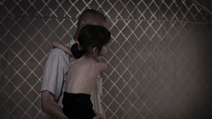 Palestinian girl faces starvation in Gaza Strip