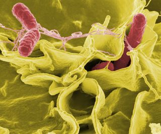 Salmonella invading human cells – just the type of scenario it would be good to target with CRISPR-Cas.