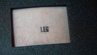 A tattoo performed by a hacked 3D printer, showing the word "leg" inked into a test subjects leg, surrounded by a clamping bracket.