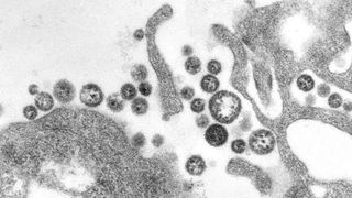 This transmission electron microscopic (TEM) image depicts Lassa virus virions adjacent to some cell debris.