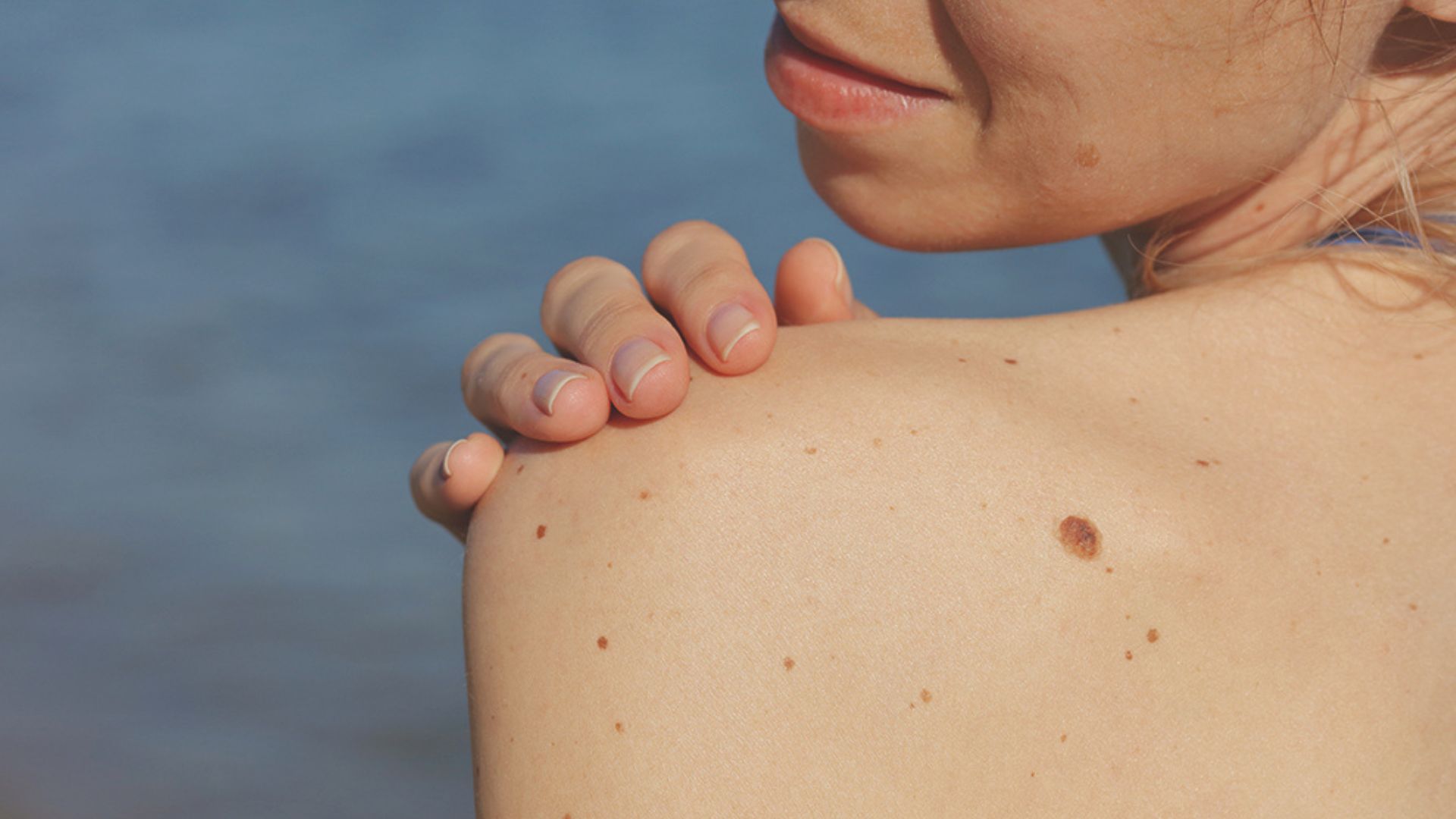 Woman checking her moles