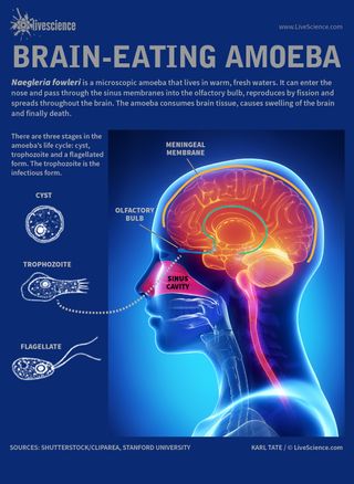 Infographic: How a tiny amoeba can eat your brain.