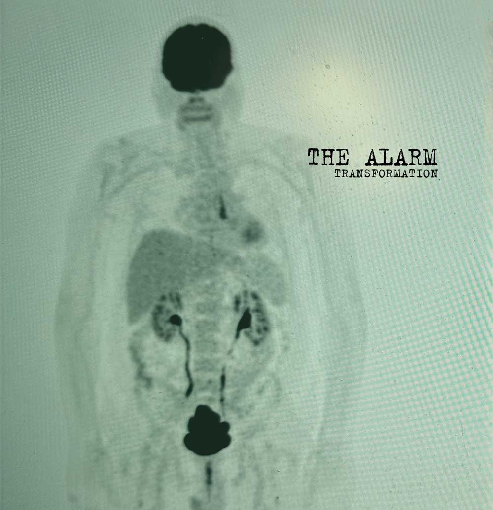 The Alarm - Transformation cover art