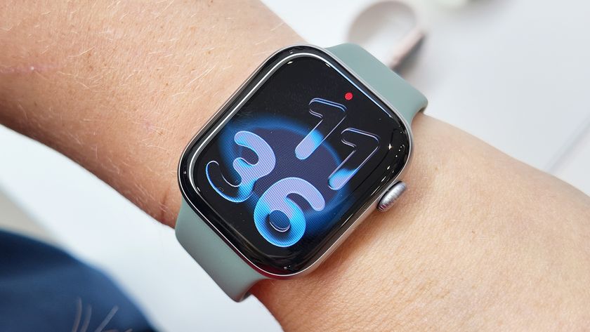 Apple Watch Series 11 close-up