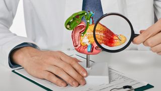 Doctor holding magnifying glass up to an anatomical model of the pancreas to show pancreatitis.
