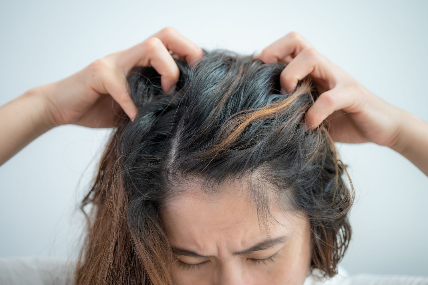 woman scratching her itchy scalp