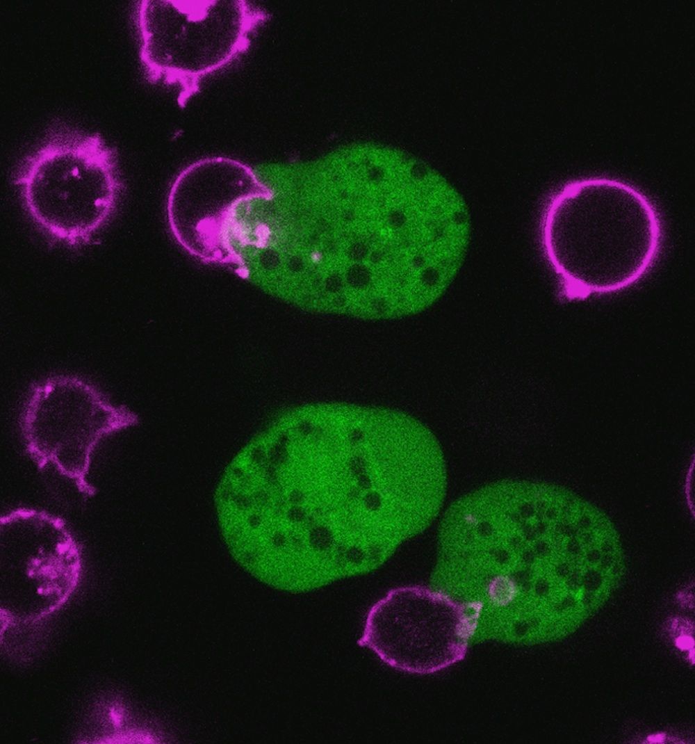 Parasitic Amoeba Eating Human Cells