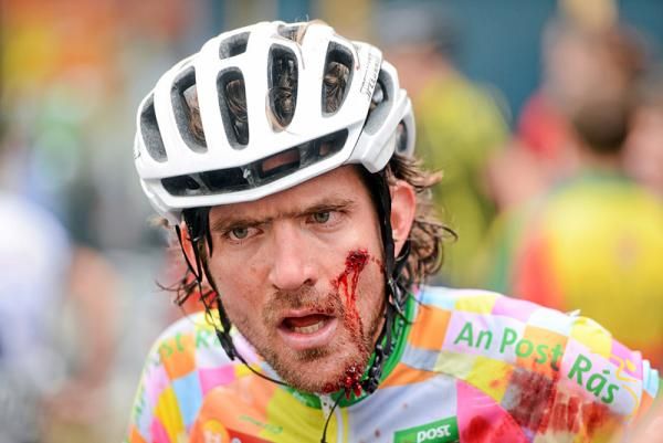 Dan Craven (Sigma Sport) shows the effects of an earlier crash following the third stage of the 2012 An Post R&aacute;s.