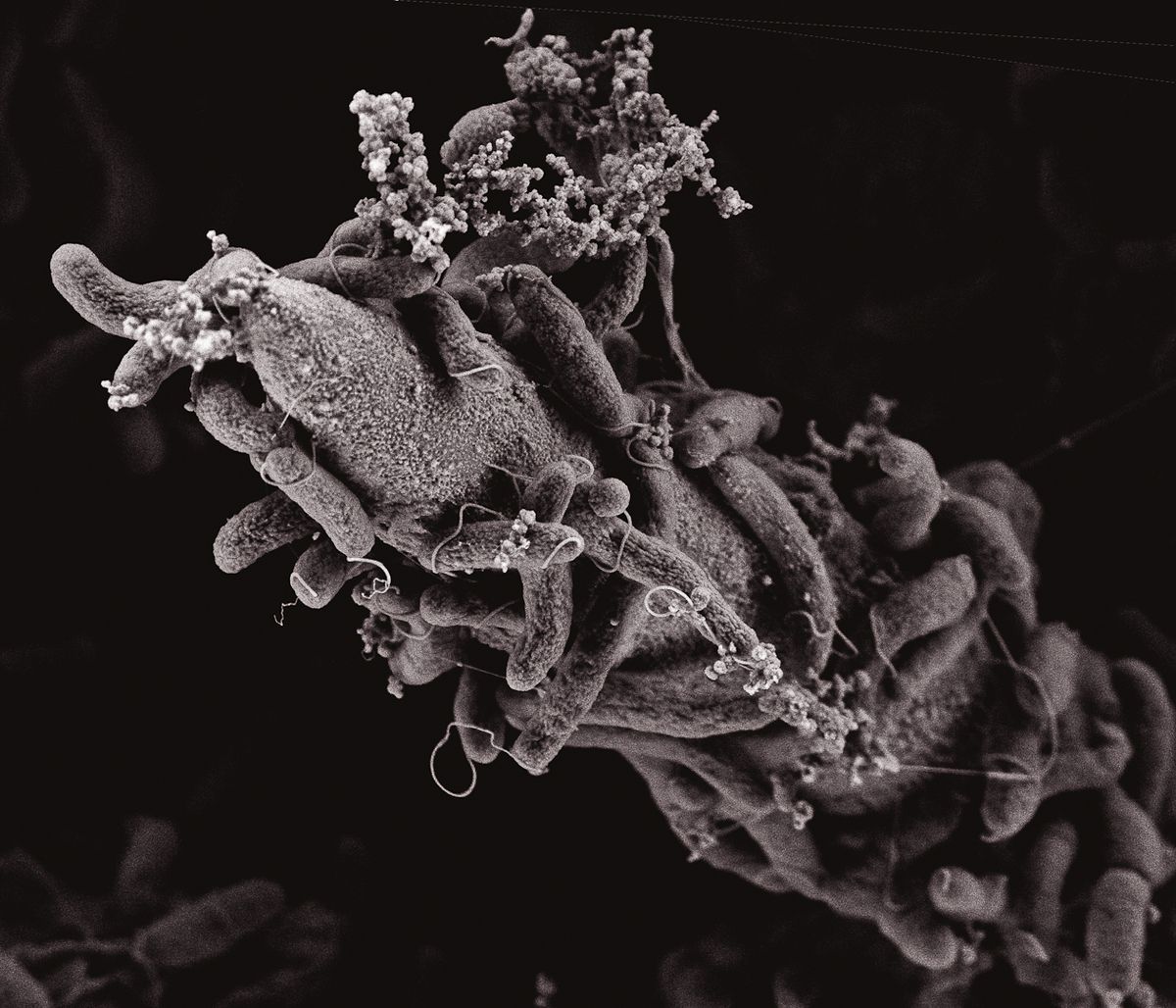 This image shows Vibrio cholerae bacteria attached to a chitin surface.