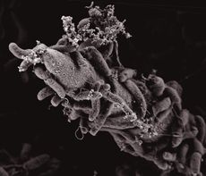 This image shows Vibrio cholerae bacteria attached to a chitin surface.