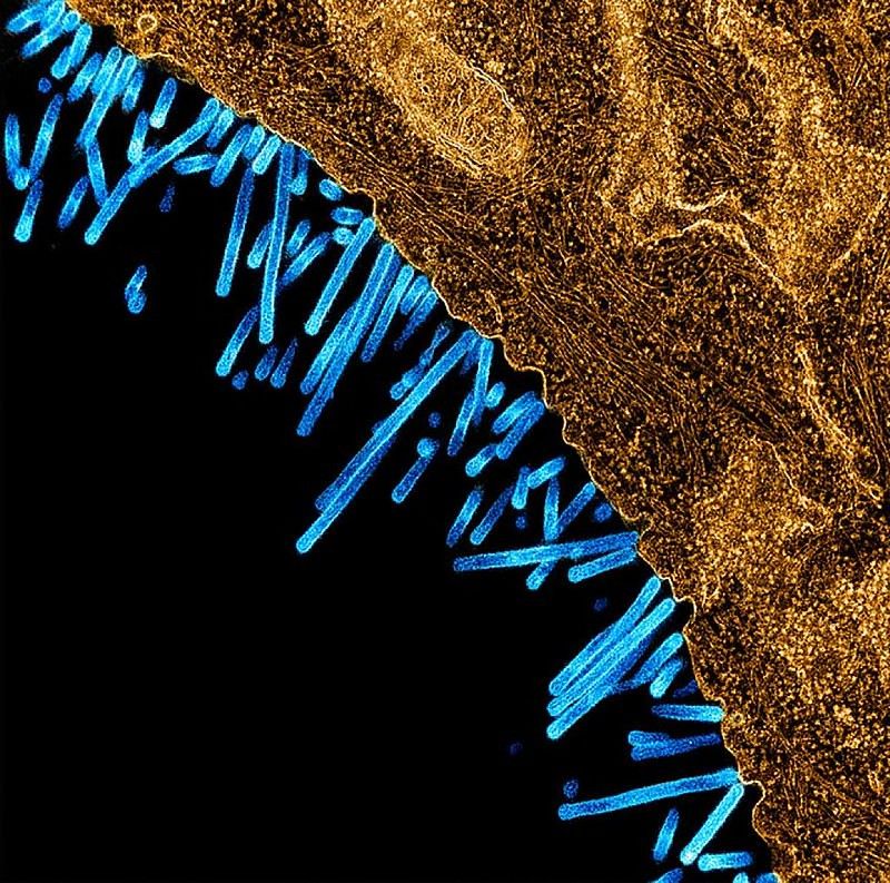 swine flu particles, depicted in blue, budding off the surface of a cell, shown in orange