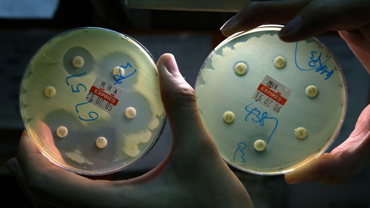 yellowish bacteria called Pseudomonas aeruginosa shown growing in two circular lab dishes; the lab dish on the left contains antibiotics that the bacteria can&#039;t grow near, while the bacteria in the right dish are still successfully growing next to the antibiotics