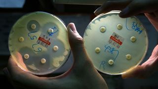yellowish bacteria called Pseudomonas aeruginosa shown growing in two circular lab dishes; the lab dish on the left contains antibiotics that the bacteria can't grow near, while the bacteria in the right dish are still successfully growing next to the antibiotics
