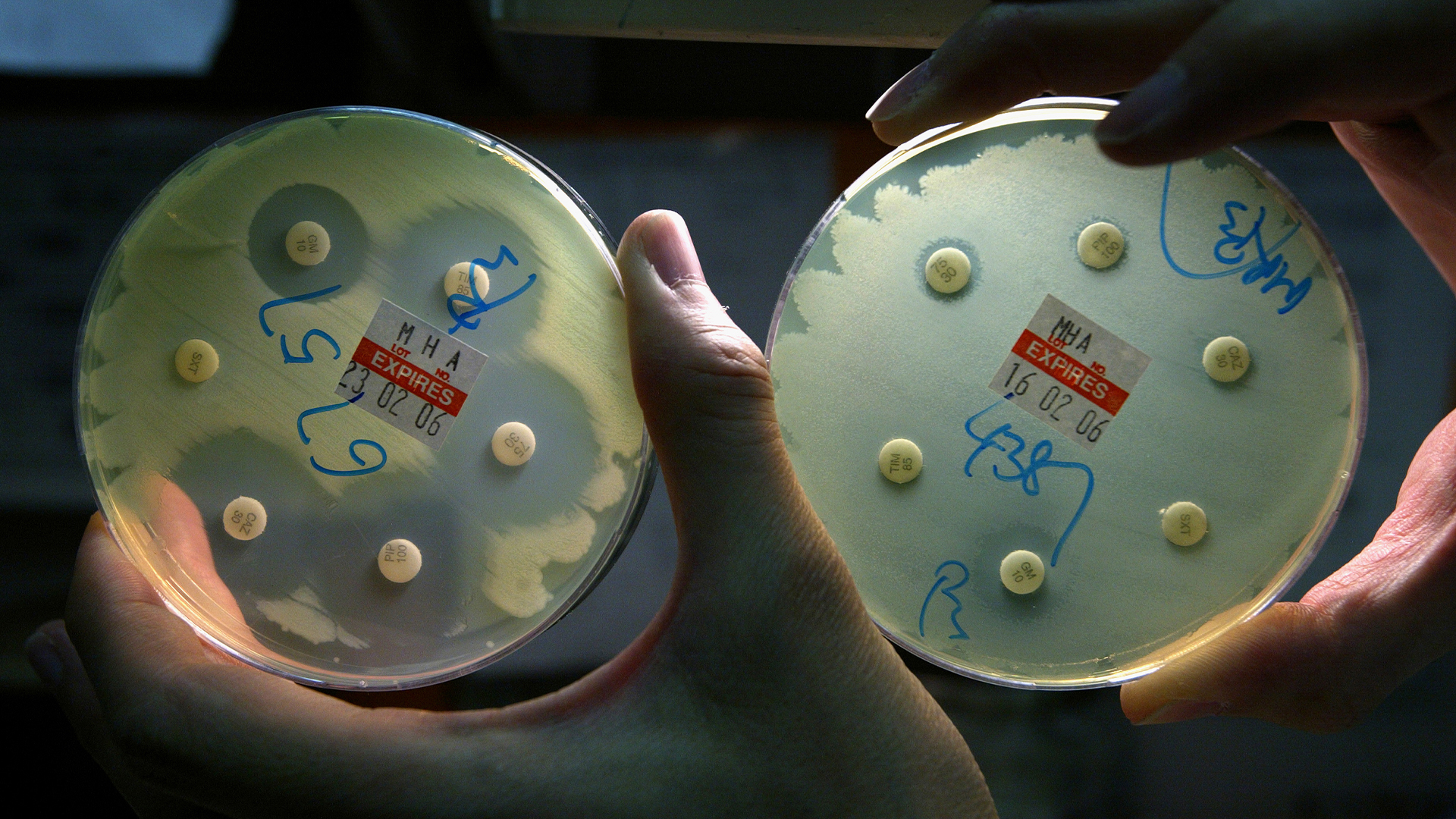 Superbugs are on the rise. How