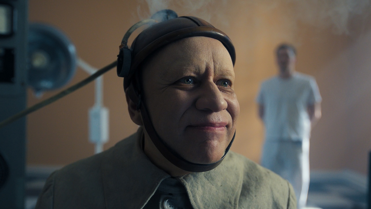 Uncle Fester's head strapped into medical device in Wednesday Season 2