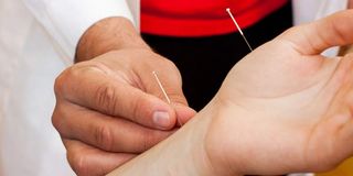 acupuncture for kids