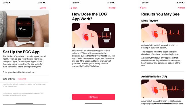 como funciona ecg apple watch