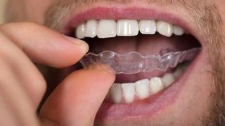 best_teeth_whitening_gum_shield