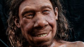 A 3D facial reconstruction of the Neanderthal dubbed Krijn, who had a tumor above his right eyebrow.