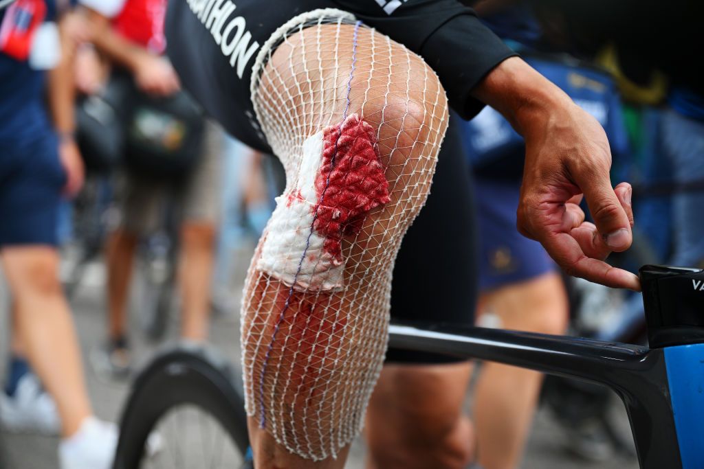 BOISSETSAINTPRIEST FRANCE JUNE 06 EDITORS NOTE Image depicts graphic content Detailed view of Oliver Naesen of Belgium and Decathlon AG2R La Mondiale Team injury after falling during the 76th Criterium du Dauphine 2024 Stage 5 a 167km stage from Amplepuis to SaintPriest Race neutralised due to a multiple riders crash and dropouts UCIWT on June 06 2024 in BoissetSaintPriest France Photo by Dario BelingheriGetty Images
