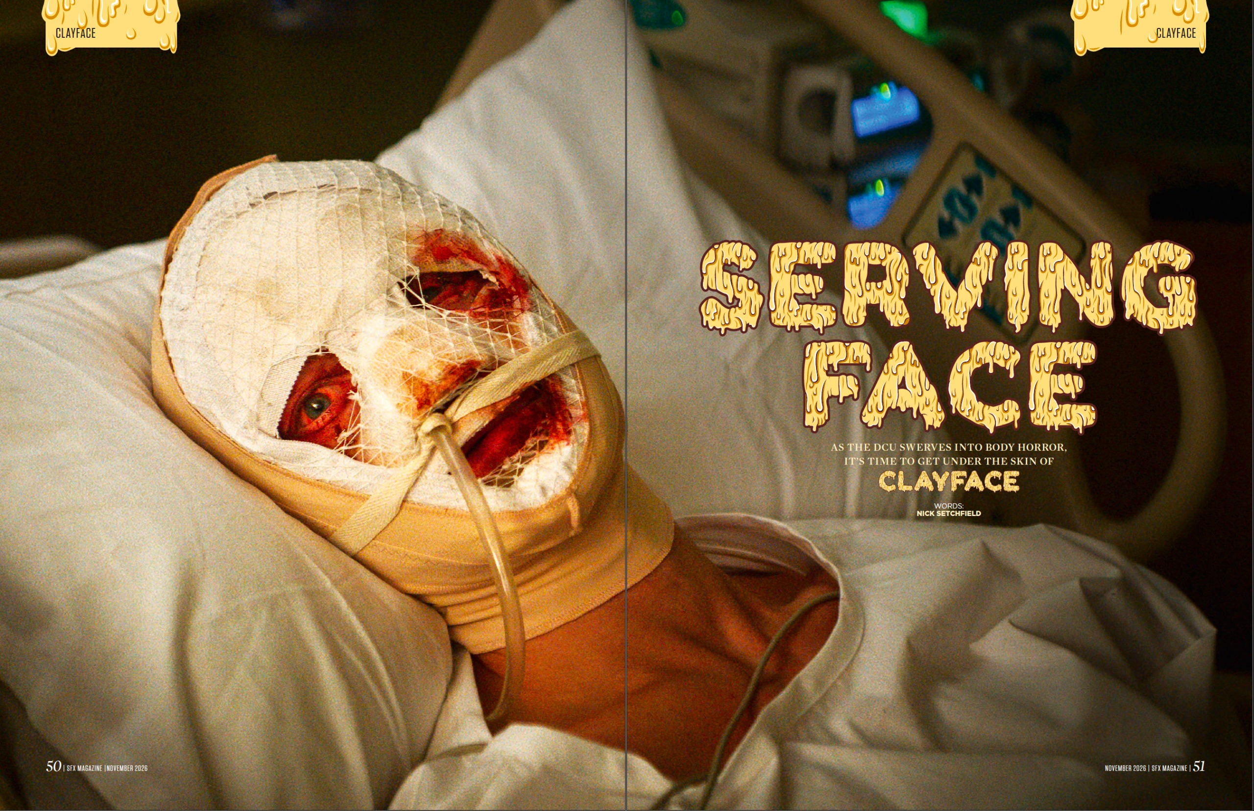 Matt Hagen in a hospital bed, his face covered in bandages.