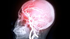 A scan of someone's skull, showing red and white lines across it