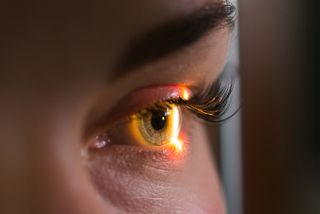 Woman's eye with light shining on it