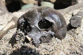A skull of an Iron Age warrior discovered in a bog in Denmark shows signs of battle.