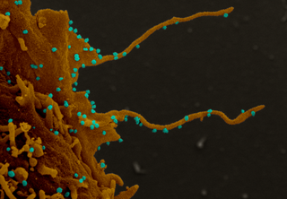 Electron microscopy images of monkey cells infected with the virus show tentacle-like projections.