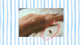 A striped background with a photograph of a hand pulling on a mattress to reveal a bed bug in the foreground. A red circle spotlights the bed bug.