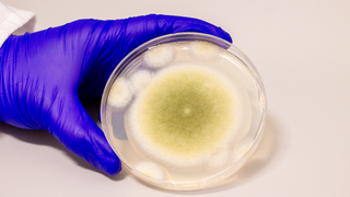 A sample of Aspergillus flavus cultured in the Gao Lab.