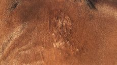 Ringworm.