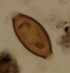 Whipworm egg