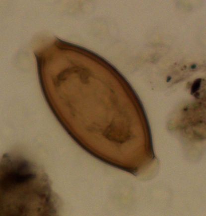 Whipworm egg